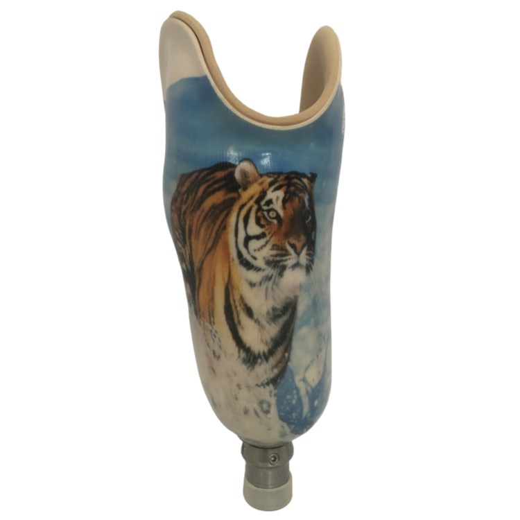 小腿假肢接受腔 殘疾康復(fù)助行支具定制